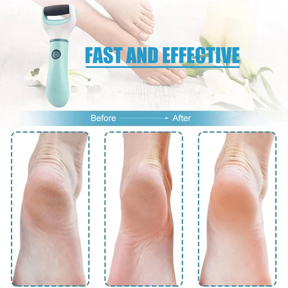 Electric Foot Grinder